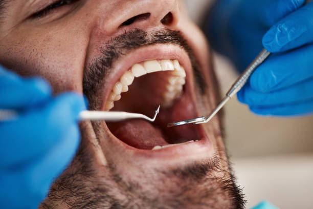 Best Emergency Tooth Extraction in Big Rock, IL