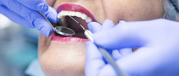 Best Emergency Dental Care for Broken or Chipped Teeth in Big Rock, IL